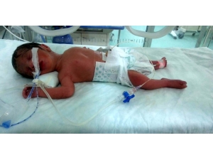 Mardinli Genç Çifte Dördüz Sürprizi