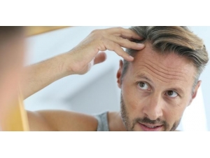 Saç Ekimi Yaptıracaklara Uyarı