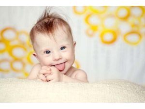 Down Sendromu Anne Karnındayken Belirlenebiliyor