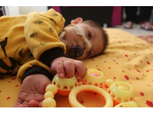 Down Sendromlu Minik Efe Sağlığına Kavuşacağı Günü Bekliyor