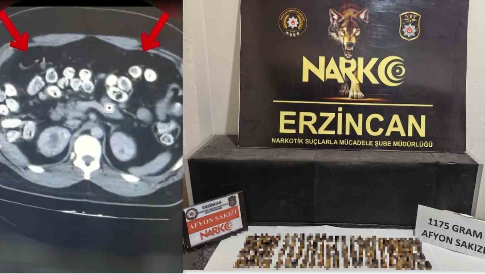 erzincan-da-uyusturucuyu-vucutlarinda-tasiyan-3-supheli-yakalandi