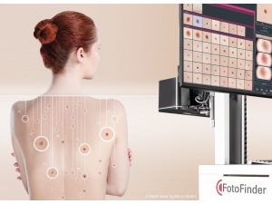 Cilt Kanserini Erken Teşhis İçin Yeni Nesil Sistemler