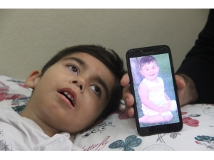 Çocukları, Gözlerinin Önünde Her Gün Ölüme Bir Adım Daha Yaklaşıyor