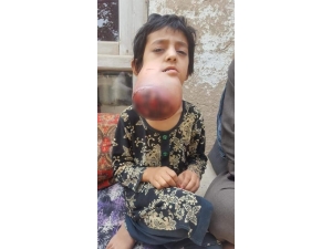 Afganistanlı Küçük Habibe Yardım Bekliyor