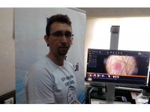 Türk Dermatoloji Derneğinin “Ben Taraması” Hayat Kurtarıyor