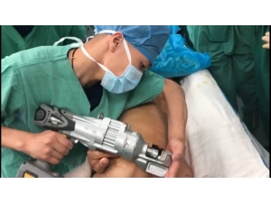 Çin’de İnşaat İşçisinin Vücuduna Saplanan Demir Çıkarıldı