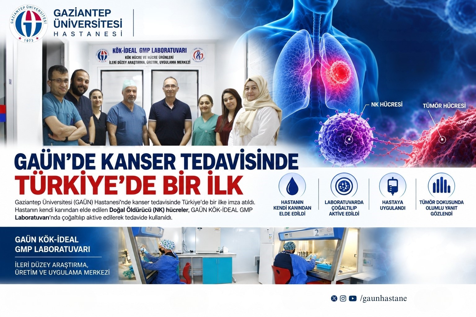 kanser-tedavisinde-turkiye-de-bir-ilk