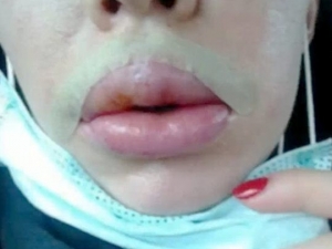 500 Kadını Mağdur Eden Sahte Güzellik Uzmanına Hapis Cezası