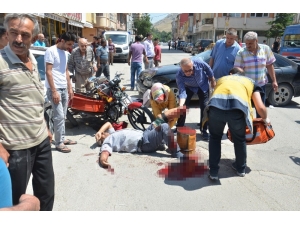 Kazada Motosiklet Sürücüsünün Ayağı Koptu