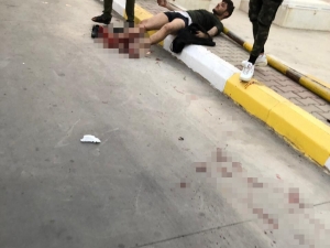 Kerkük’te Art Arda 2 Patlama: En Az 24 Yaralı