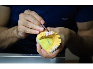 Bir Diş Protezinin Serüveni