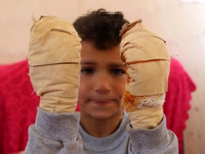 Komşu Çocuğu, Küçük Efe’ye Dehşeti Yaşattı