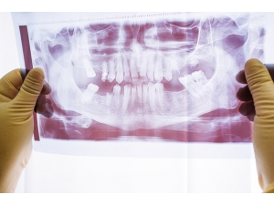 Dr. Öğr. Üyesi Ahmet Karaman “Çene Eklem Rahatsızlığı En Çok Kadınları Etkiliyor”