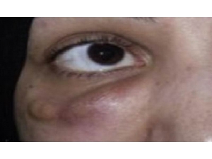 Güzel Olmak İçin Güzelliğinizden Olmayın