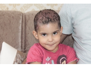 Kafa Derisinde Yaralar Çıkan 3 Yaşındaki Lorin’in Tedavisine Başlandı