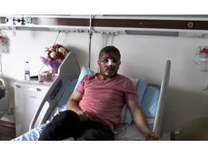 Motosiklet Kaskı Kırık Diye Takmayan Sürücü Dehşeti Yaşadı