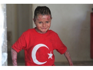 Suriyeli ’Kelebek’ Hastası Aladdin’in Türkiye Aşkı