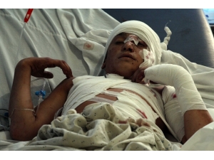 Afganistan’da Otobüse Bombalı Saldırı: 34 Ölü