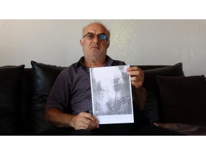 Ameliyatla Vücuda 3 Aylığına Takılıp Unutulan Yarım Metrelik Tel, 28 Ay Süren Ağrıyla Ortaya Çıktı