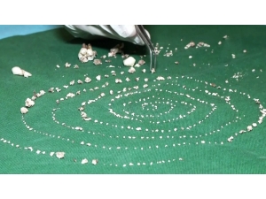 7 Yaşındaki Çocuğun Ağzından 526 Diş Çıkarıldı