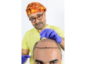 Saç Ekimi Ve Estetikten Gelen Para 1 Milyar Doları Geçti