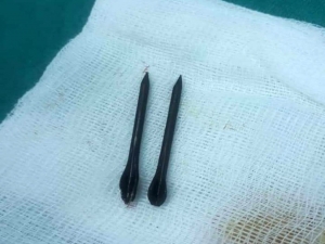 Esad Rejimi, Çivi Bombaları Kullanmaya Devam Ediyor