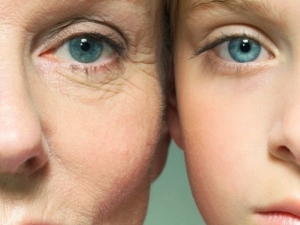 Örümcek Ağı Estetiği İle Gençleşin