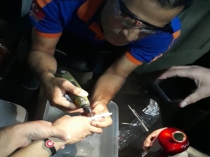 Parmağa Sıkışan Yüzüğü Afad Ekibi Çıkardı