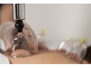 Beden Saatini Yeniden Kurmanın Anahtarı Hacamat Ve Akupunkturda