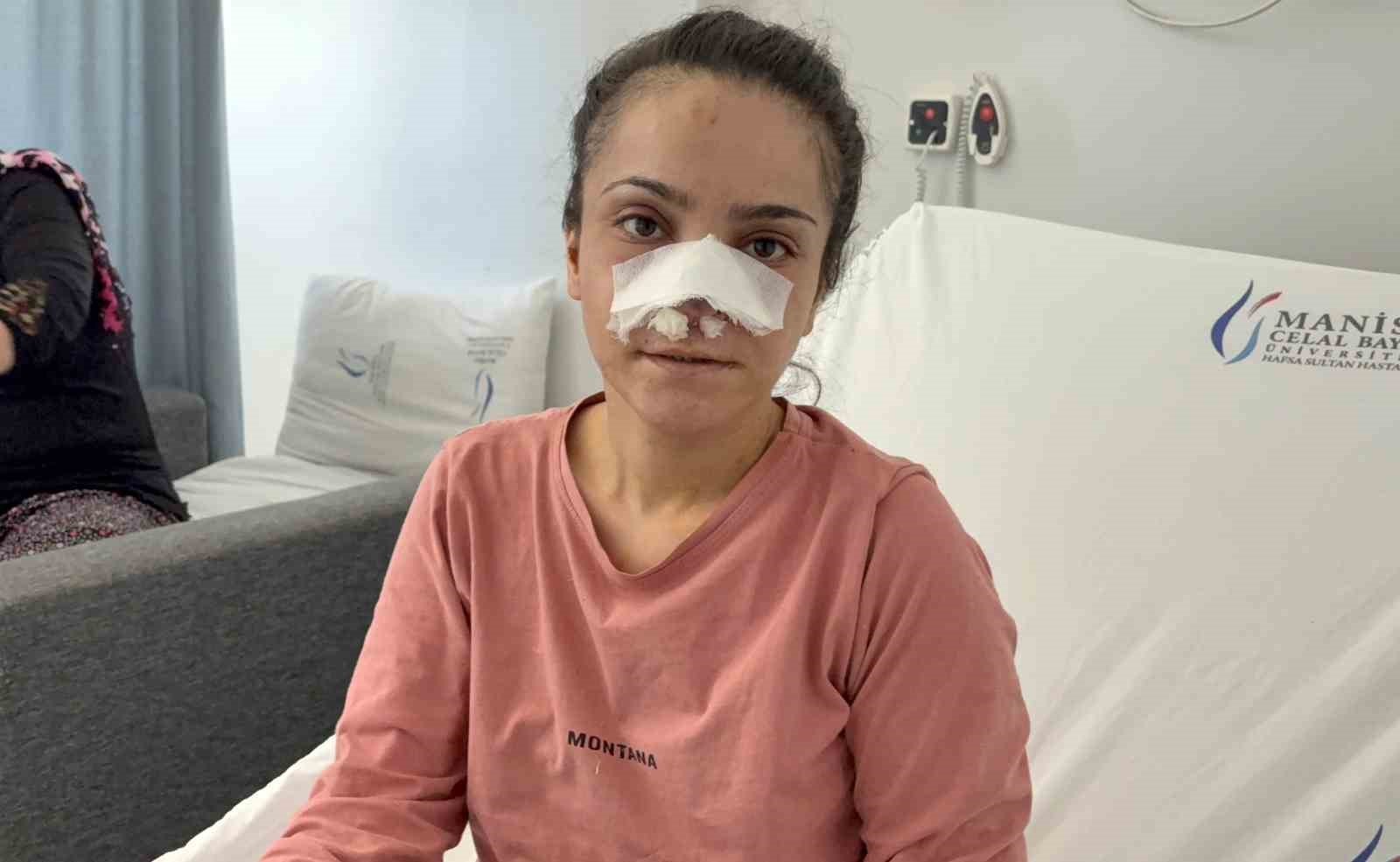 esinin-kopardigi-burnu-basarili-operasyonla-yerine-dikildi