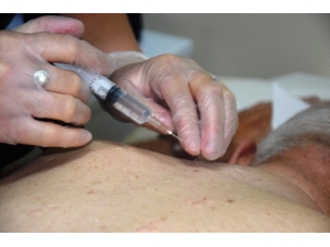 Akupunktur, Ozon Tedavisi, Nöralterapi İle Sağlığına Kavuştu