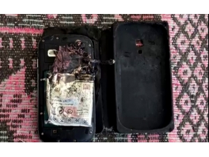 Patlayan Cep Telefonu Bacağını Parçaladı