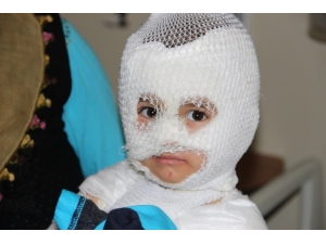 Isıtıcıdaki Kaynar Su Üzerine Dökülen Çocuk Ölümden Döndü