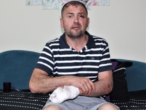 Ayaklarını Uzattığı Gerekçesi İle Gaziyi Darp Edenler Hakim Karşısında