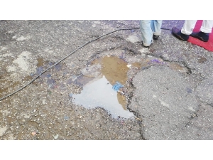 Çukur 75 Yaşındaki Kadını Hastanelik Etti