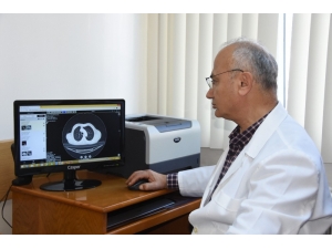 5 Milyon Koah Hastasından 500 Bini Tanısını Biliyor