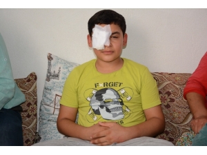 Sol Gözünü Kaybetti, Yardım Gelmezse Sağ Gözünü De Kaybedecek