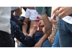 Bıçaklanarak Kanlar İçinde Kaldı Cep Telefonuyla Olayı Arkadaşına Anlattı