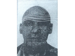 Su Kaydırağına Başını Çarpan Gurbetçi, Hastanede Hayatını Kaybetti