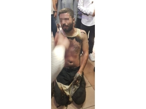 Eşiyle Tartışınca Sokakta Kendini Yaktı