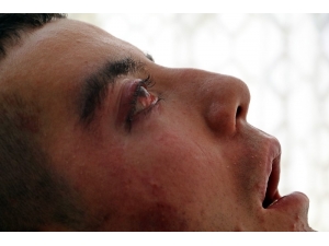 5 Yıldır Gözlerini Kırpamıyor, Adeta Kan Ağlıyor