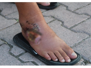 Aslan Balığının Zehirlediği Balıkçı: "Bir Daha Yanından Bile Geçmem"