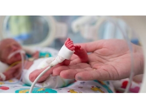 Her Yıl Doğan 15 Milyon Prematüre Bebekten 1 Milyonu Hayatını Kaybediyor