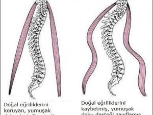 Omurga Yetmezliğine Dikkat