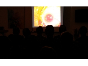 Göz Doktorlarına Canlı Yayında Katarakt Ameliyatı