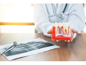 Finansman Kolaylıklarıyla İmplant Uygulamalarına Talep Artıyor