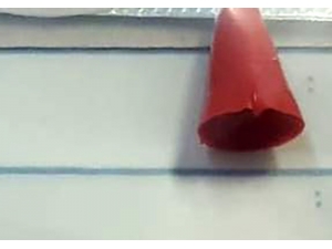 Mert’in Ölümüne Neden Olan O Parça Otopsiyle Çıkarıldı