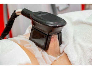 Soğuk Lipoliz İle Bölgesel İncelme