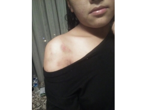 Şiddete Uğradığını İddia Eden Nepalli Genç Kız Sosyal Medyadan Yardım İstedi