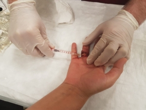 Evde Temizlik Yaparken Düşen Kadın Neredeyse Parmağından Olacaktı